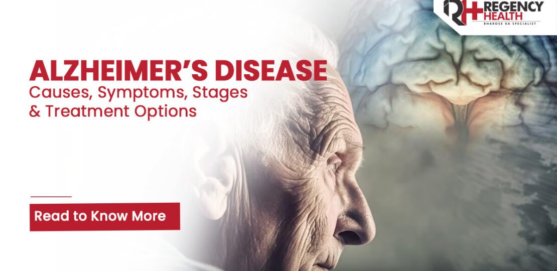 Alzheimers-Disease-Causes-Symptoms-Stages-and-Treatment-Options.jpg