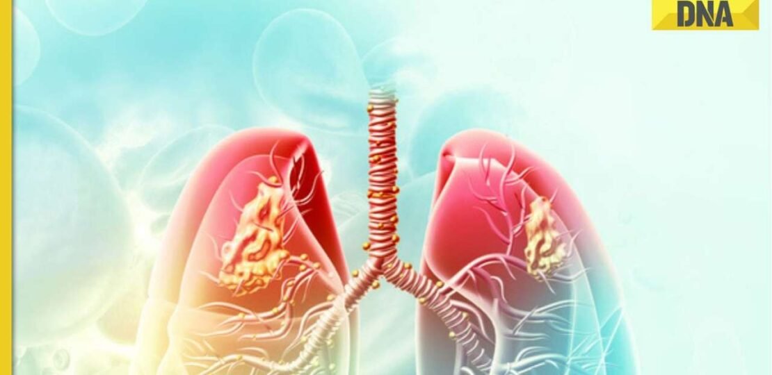 Lung-Cancer-Awareness-Month-What-is-lung-cleansing-why-should-you-do-it.jpg